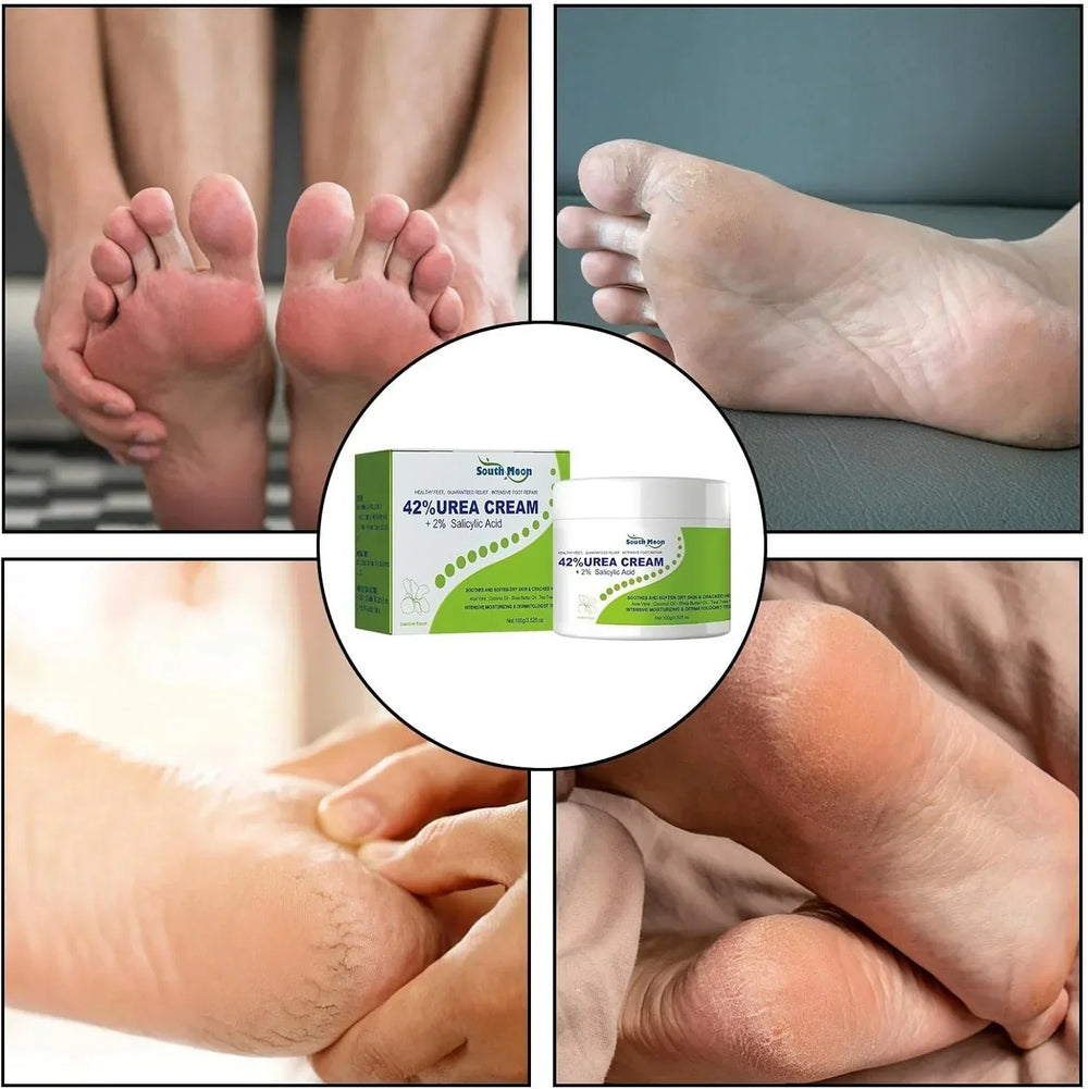 South Moon - 42% Urea Cream + 2% Salicylic Acid (Original) - DubaiTrends